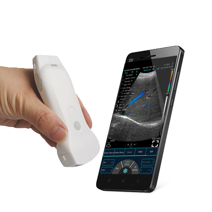 Point of Care Ultrasound Convex and Linear