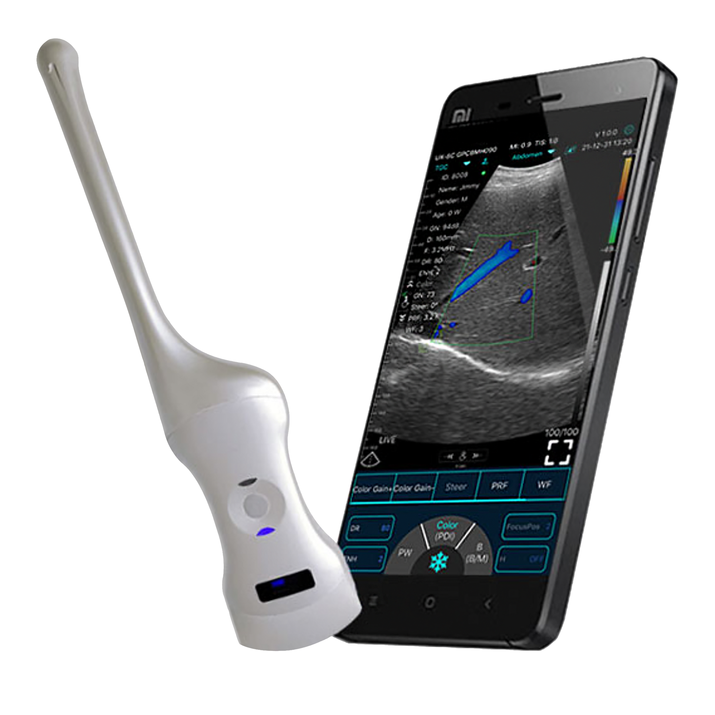 point-of-care-ultrasound-transvaginal-mohs-online