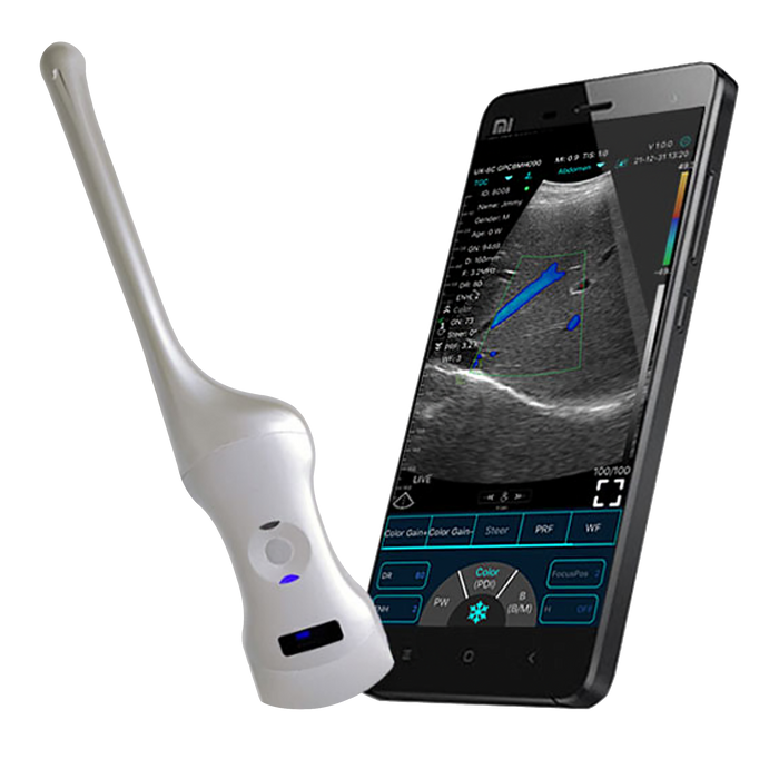Point of Care Ultrasound Transvaginal